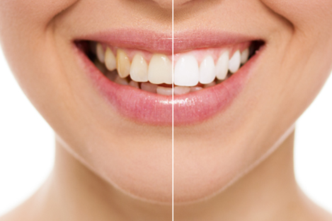 cosmetic dentistry ujjain